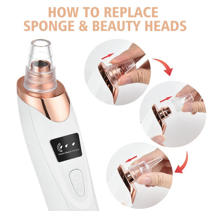 Electric Blackhead Remover